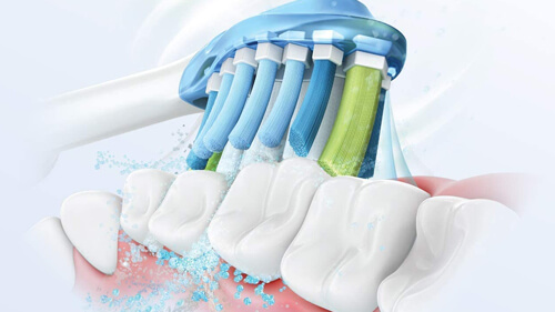 電動歯ブラシの効果とメリット