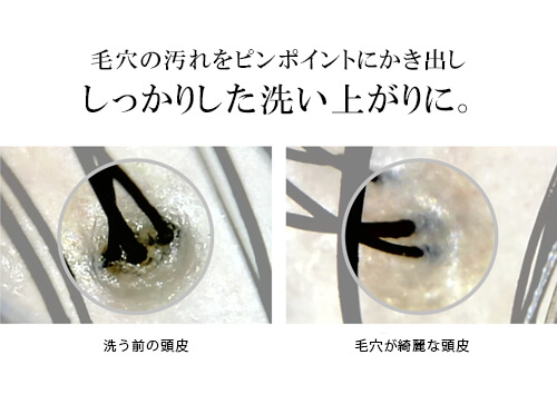 ヘッドマッサージャー 効果 毛穴汚れ 皮脂