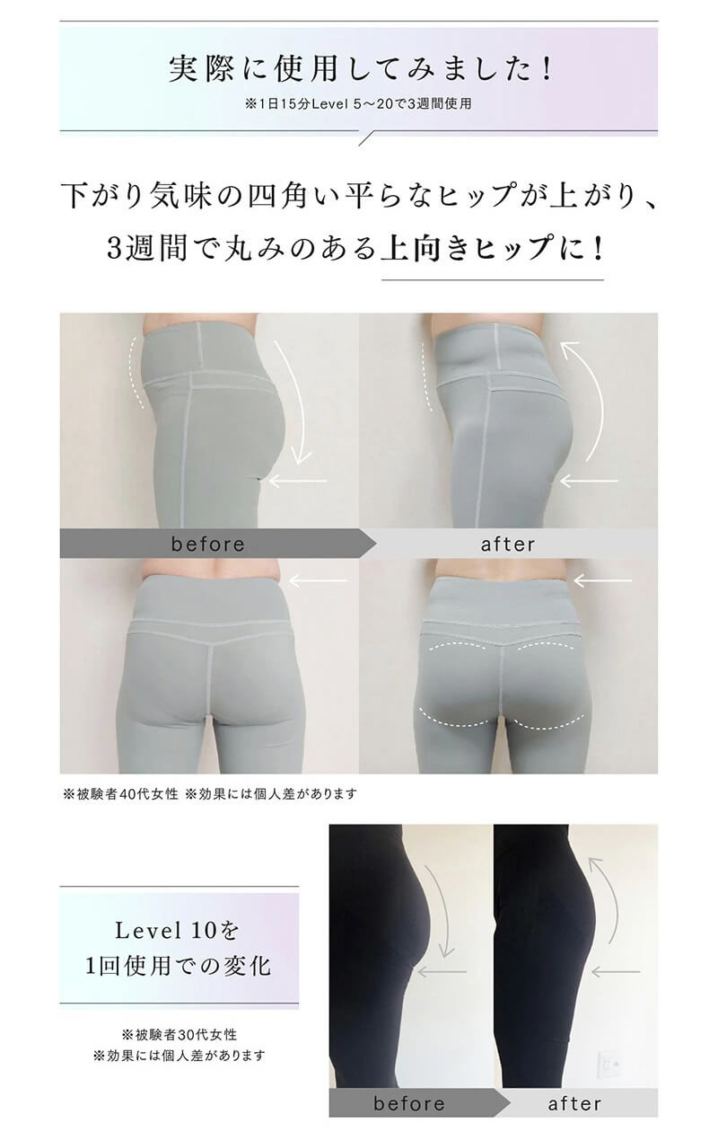 EMS骨盤底筋トレーニング機器の効果とは 美尻効果